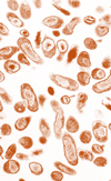 Coxiella burnetii (NIH)