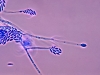 fusarium_verticillioides-fuente-wikipedia