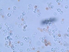 o_yeastFormFungi