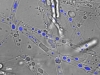 pythium-ultimum-fuente-helmholtz-center