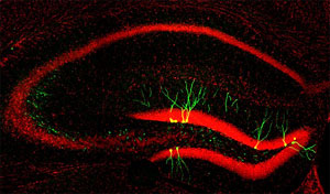 Generacin de nuevas neuronas en el giro dentado (neurognesis), identificada mediante el uso de vectores retrovirales y la expresin de la protena verde fluorescente Venus. Los ncleos celulares y la anatoma del hipocampo se pueden observar en rojo (Topro3)