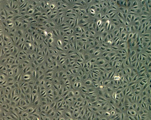 Clulas endoteliales - Vascuzell