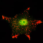 Clula infectada por el Citomegalovirus humano. Autor: M Victoria Cepeda y Alberto Fraile