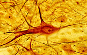Preparacin original de Ramn y Cajal de la neurona motora de la mdula de gato