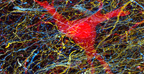 Neurona del tronco enceflico