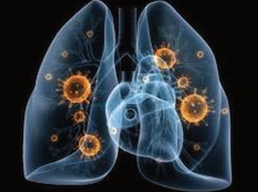 Mejora en el tratamiento del cáncer de pulmón