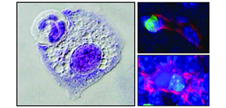 Imágenes microscópicas de macrófagos en el proceso de comerse otra célula, o con la célula ya en su interior