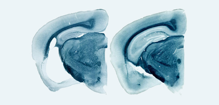 Reducción de áreas cerebrales en un ratón portador del gen ‘ApoE4’ humano (derecha). / YANG SHI (WUSM)