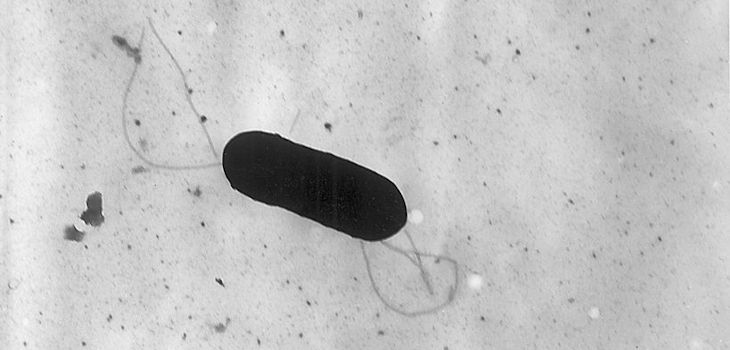 Microfotografía electrónica de una bacteria flagelada de Listeria monocytogenes, Magnified 41,250X. / Elizabeth White (WIKIMEDIA)