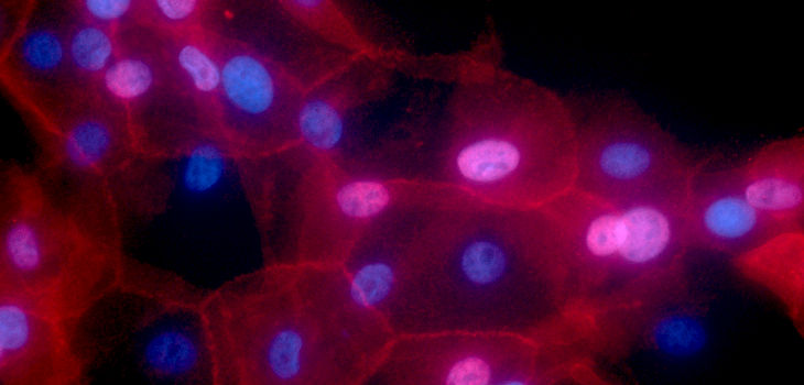 La imagen muestra el cultivo de células de cáncer de mama humano condicionalmente células reprogramadas. El color rojo de la fluorescencia representa el MHC-I, y los núcleos se muestran en azul. / Ewa Krawczyk (National Cancer Institute \ Georgetown Lombardi Comprehensive Cancer Center)