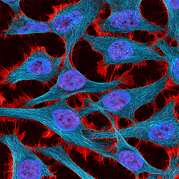 La gran capacidad proliferativa de las células cancerígenas puede ser su perdición