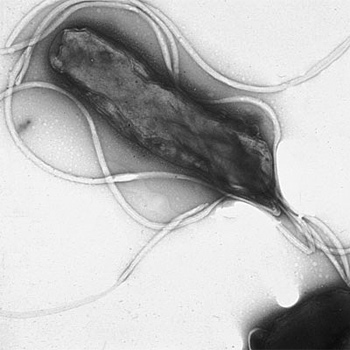 Helicobacter pylori visto al microscopio electrónico, mostrando numerosos flagelos sobre la superficie celular. / Yutaka Tsutsumi, M.D (WIKIMEDIA)