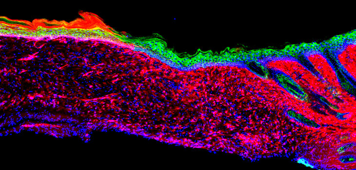  La imagen representa la primera prueba para la regeneración exitosa de un órgano funcional (la piel) dentro de un mamífero. / Salk Institute 