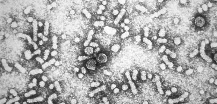 Virus hepatitis b. /  CDC (WIKIMEDIA)