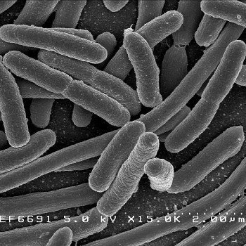 Escherichia coli, una de las muchas especies de bacterias presentes en el intestino humano. / Rocky Mountain Laboratories, NIAID, NIH - NIAID (WIKIMEDIA)