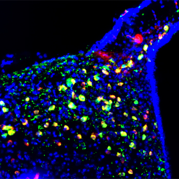 Imagen de microscopía de fluorescencia del núcleo arcuado del hipotálamo donde se aprecian, en color verde, las neuronas POMC. / Alicia G Gómez-Valadés