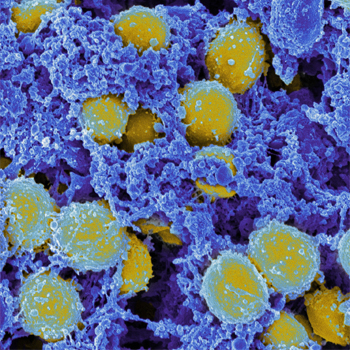 Micrografía de bacterias Stpahylococcus aureus. / NIAID (FLICKR)