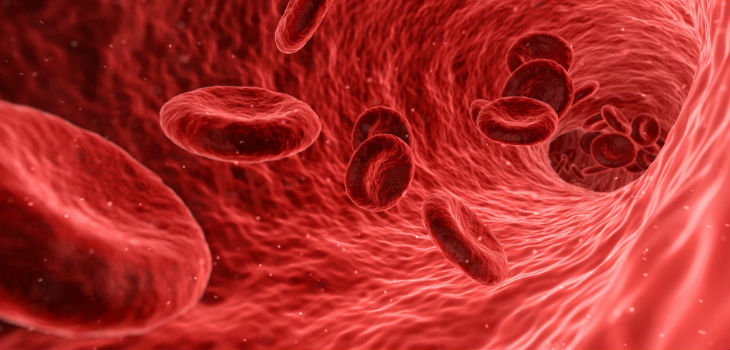 Expression of a molecule in blood cells predicts atherosclerosis risk 