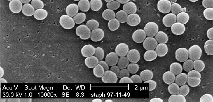  Una cepa de la bacteria Staphylococcus aureus tomada de un cultivo resistente a la vancomicina intermedia (VISA). / CDC/ Matthew J. Arduino, DRPH; Janice Carr (WIKIMEDIA) 