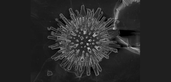 Biomorfo de cal y sílice observados mediante microscopía electrónica de barrido./ CSIC