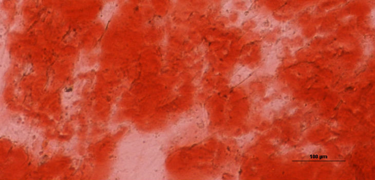 Células madre mesenquimales diferenciadas a células de hueso sobre matrices generadas a partir de fibroblastos tratados con LOX y BMP1. / Tamara Rosell García, Fernando Rodríguez Pascual.