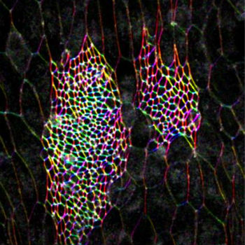 Nidos dorsales de histoblastos de Drosophila al inicio de su expansión. / IBMB