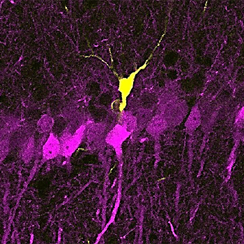 Una nueva técnica aísla la actividad neuronal durante la consolidación de la memoria