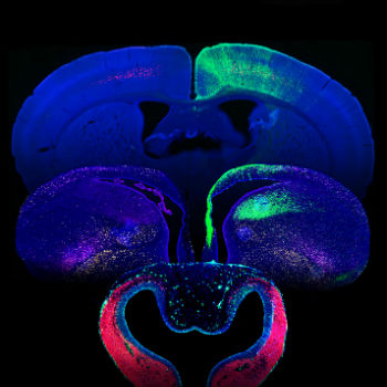 Imágenes de fluorescencia de cortes de cerebro de serpiente (frente), pollo (intermedio) y ratón (detrás) ilustrando las diferencias en grosor, tamaño y cantidad de neuronas en la corteza cerebral (verde). / CSIC-UMH