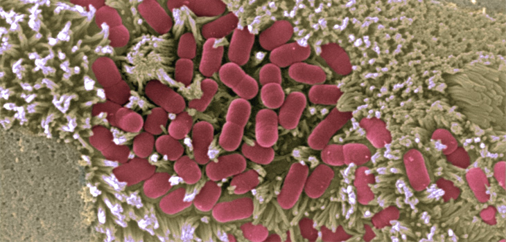 Imagen microscópica de la mucosa intestinal afectada por E. coli / (CNB/CSIC)