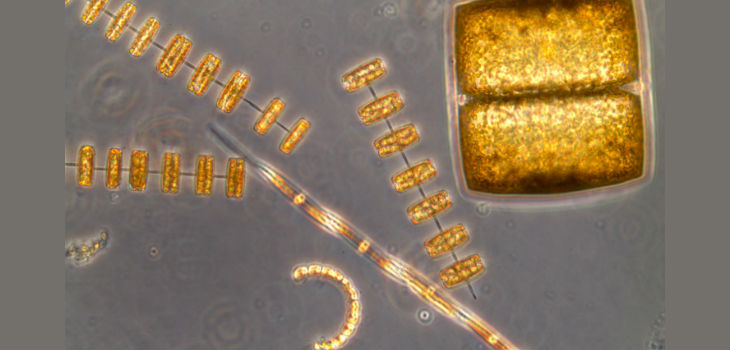 Células de diatomeas observadas al microscopio. / Isabel G. Teixeira