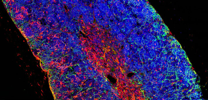  Imagen de un timo, órgano donde se inicia la transformación de las células que generan la leucemia aguda de células T. / CSIC 