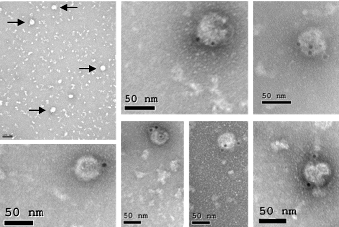 Detección mediante microscopía electrónica de partículas virales semejantes al virus del Zika generadas por la vacuna MVA-ZIKV. / CSIC