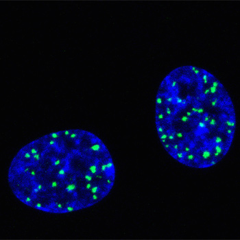 Roturas del ADN (puntos verdes) en el núcleo de células tratadas con un agente de quimioterapia. / F.C.