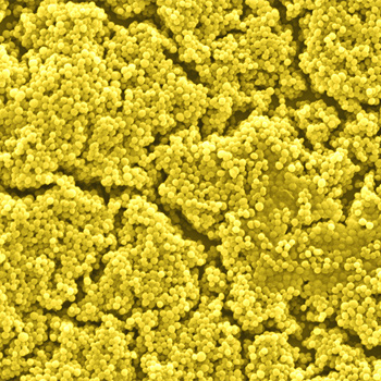 Imagen de microscopía con filtro amarillo de la bacteria ‘Staphylococcus aureus’ / (CSIC)
