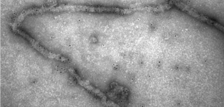 Detección mediante microscopía electrónica de partículas virales semejantes al virus del Ébola. / CSIC