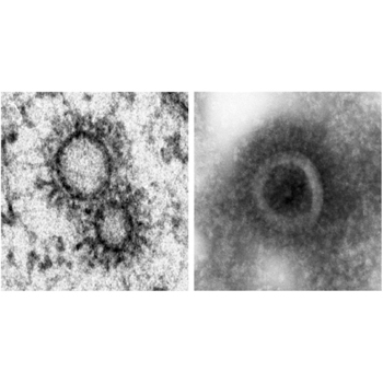 Vesículas con moléculas del genoma del virus de la gripe. / Fernández y Risco / Sachse (CSIC)