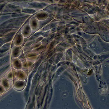 Microorganismo marino, Ascomycete fungus. / Peter G. Werner (WIKIPEDIA)
