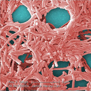 Micrografía electrónica que muestra una gran agrupación de bacterias de la Legionella. / Janice Haney Carr; provided by CDC/ Margaret Williams, PhD; Claressa Lucas, PhD;Tatiana Travis, BS (WIKIMEDIA)