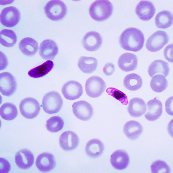 Micrografía de un frotis de sangre que contiene un microgametocito del parásito Plasmodium falciparum. / Content Providers(s): CDC/Dr. Mae Melvin Transwiki approved by: w:en:User:Dmcdevit (WIKIEMDIA)