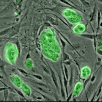 Micrografía de células madre embrionarias de ratón teñidas con un marcador fluorescente verde. / (WIKIMEDIA)