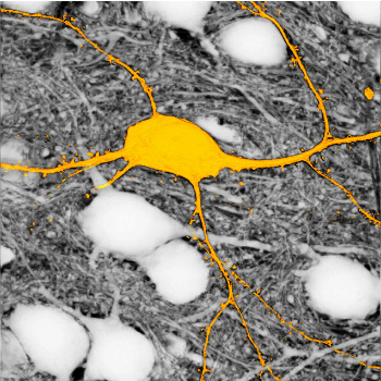 Imagen de la neurona etiquetada en amarillo, rodeada de neuronas no marcadas (aparecen en blanco), utilizando la técnica SUSHI. Sin esta técnica, las neuronas que aparecen en blanco no se verían.  / © Jan Tønnesen & Valentin Nägerl