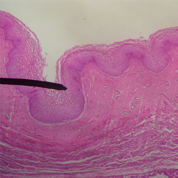 Mucosa vaginal normal, estratificada sin el desarreglo típico del cáncer de vagina. / Jpogi en Wikipedia Inglesa (WIKIMEDIA)
