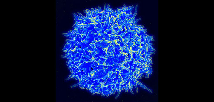Micrografía de un linfocito T humano (también llamado célula T) del sistema inmune de un donador sano. / NIAID/NIH (WIKIMEDIA)