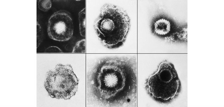  Varios virus de la familia Herpesviridae vistos usando una micrografía electrónica. Entre estos miembros está la varicela-zoster (varicela) y el herpes simple tipo 1 y 2 (HSV-1, HSV-2). / CDC/ E. L. Palmer (PIXABAY) 