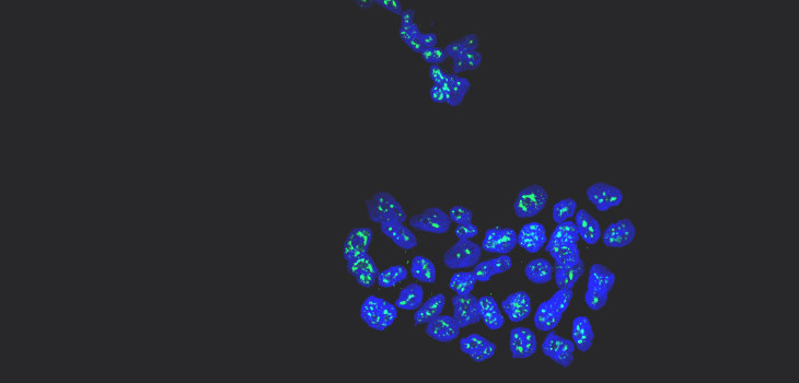 Núcleos de células metastáticas de cáncer de mama con la proteína MSK1 en verde. / Cristina Figueras-Puig, IRB Barcelona)