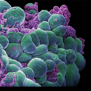 Conjunto de células de cáncer de mama. / Annie Cavanagh. images@wellcome.ac.uk (FLICKR)