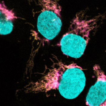 La microscopía confocal muestra la co-localización de EXD2 (magenta) con el ribosoma mitocondrial (amarillo). El ADN se tiñe para definir el núcleo (cian). / Travis Stracker, IRB Barcelona