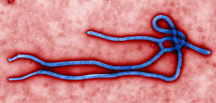 Morfología del virus del ébola. / Cynthia Goldsmith, USCDCP (PIXNIO)