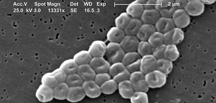 Bacteria Acinetobacter baumannii. / Janice Carr, CDC's Public Health Image Library (WIKIMEDIA)