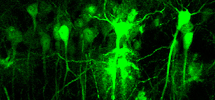 Neuronas hipocampales infectadas con partículas lentivirales que expresan la proteína verde fluorescente para la inactivación del receptor de dopamina D2. / CSIC